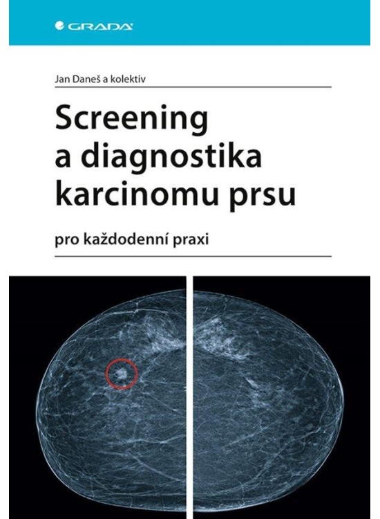 Screening a diagnostika karcinomu prsu pro každodenní praxi