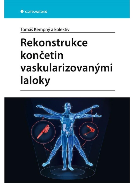 Rekonstrukce končetin vaskularizovanými laloky