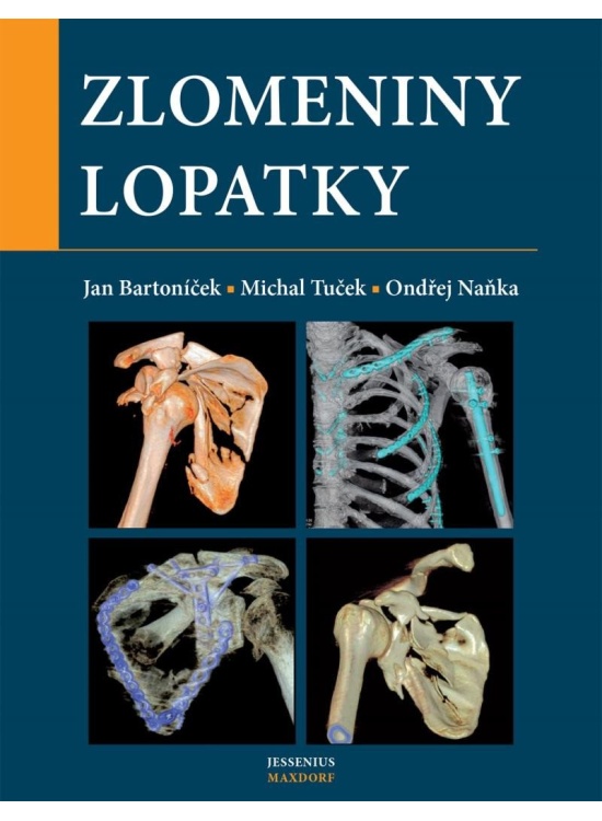 Levně Zlomeniny lopatky