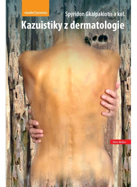 Levně Kazuistiky z dermatologie