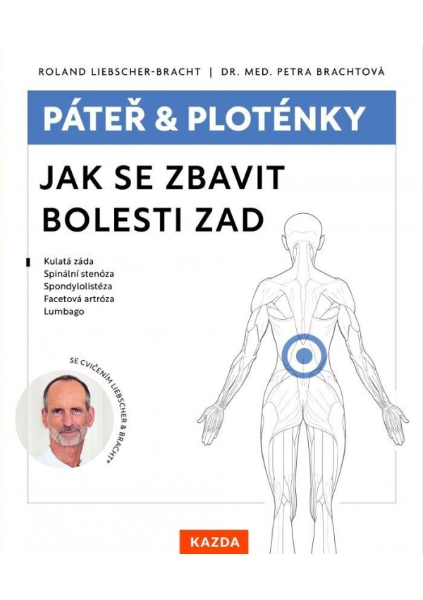 Páteř a ploténky - Jak se zbavit bolesti zad