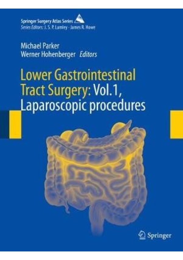 Lower Gastrointestinal Tract Surgery: Vol.1, Laparoscopic procedures Springer Nature Switzerland AG