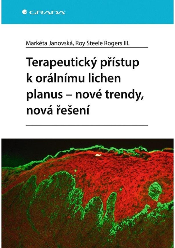 Levně Terapeutický přístup k orálnímu lichen planus - nové trendy, nová řešení