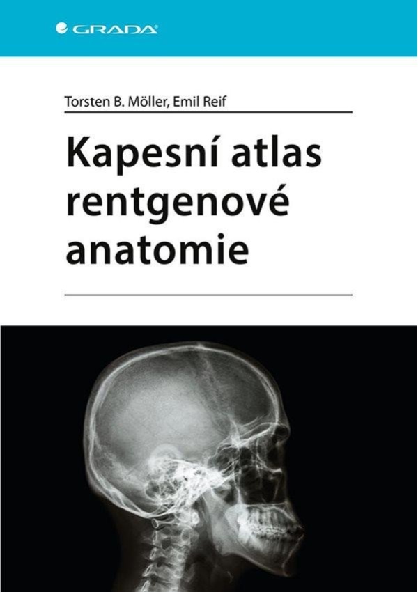 Levně Kapesní atlas rentgenové anatomie