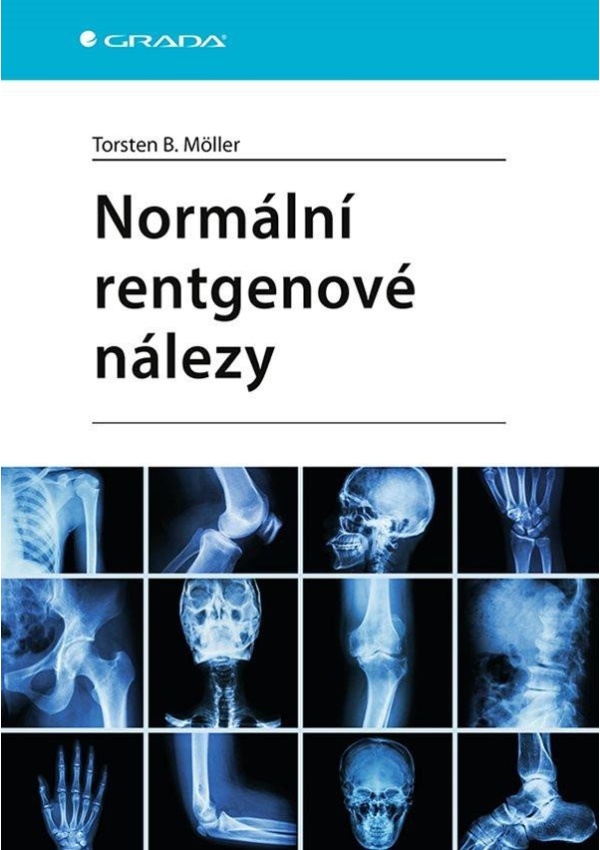 Levně Normální rentgenové nálezy