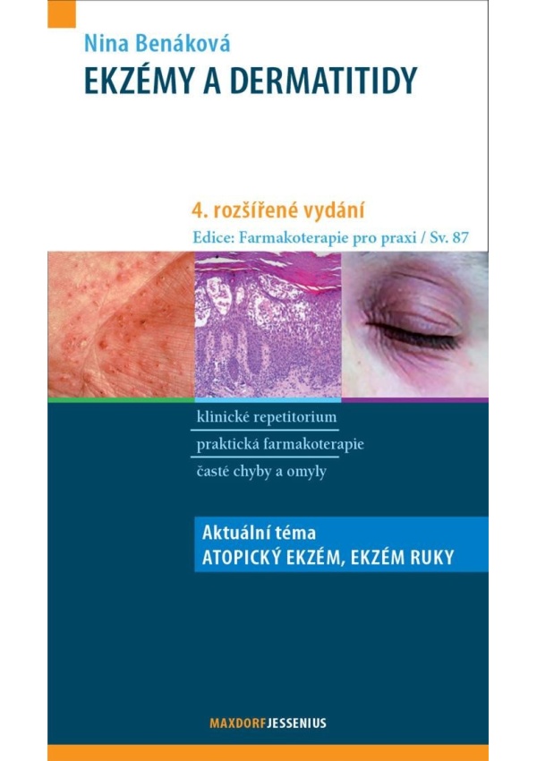 Levně Ekzémy a dermatitidy