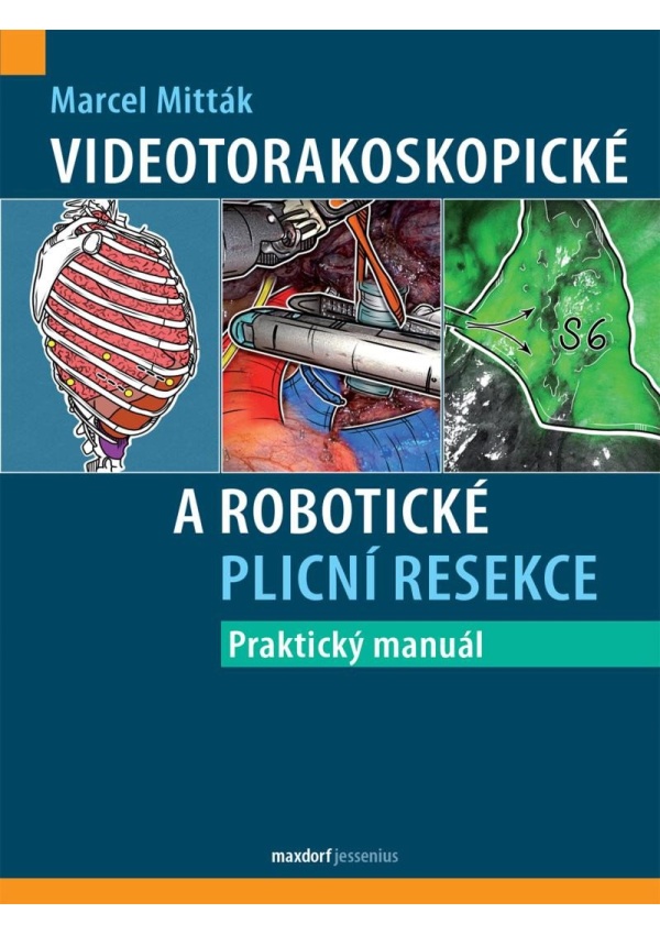 Levně Videotorakoskopické a robotické plicní resekce