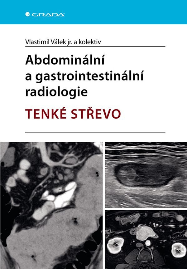 Levně Abdominální a gastrointestinální radiologie - Tenké střevo
