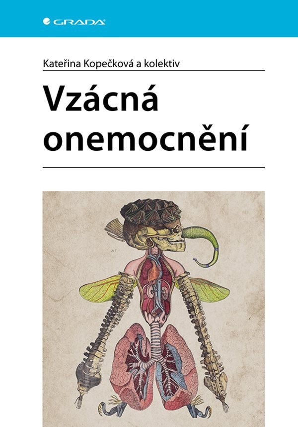 Levně Vzácná onemocnění