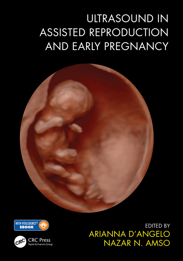 Levně Ultrasound in Assisted Reproduction and Early Pregnancy