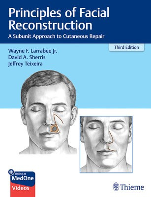 Principles of Facial Reconstruction, A Subunit Approach to Cutaneous Repair