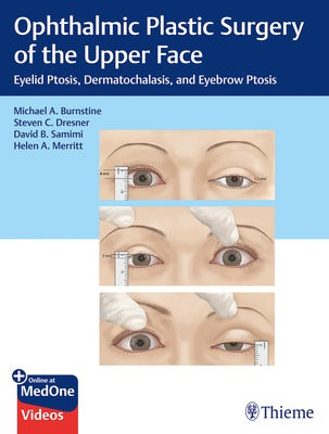 Ophthalmic Plastic Surgery of the Upper Face, Eyelid Ptosis, Dermatochalasis, and Eyebrow Ptosis