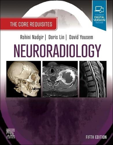 Neuroradiology, The Core Requisites
