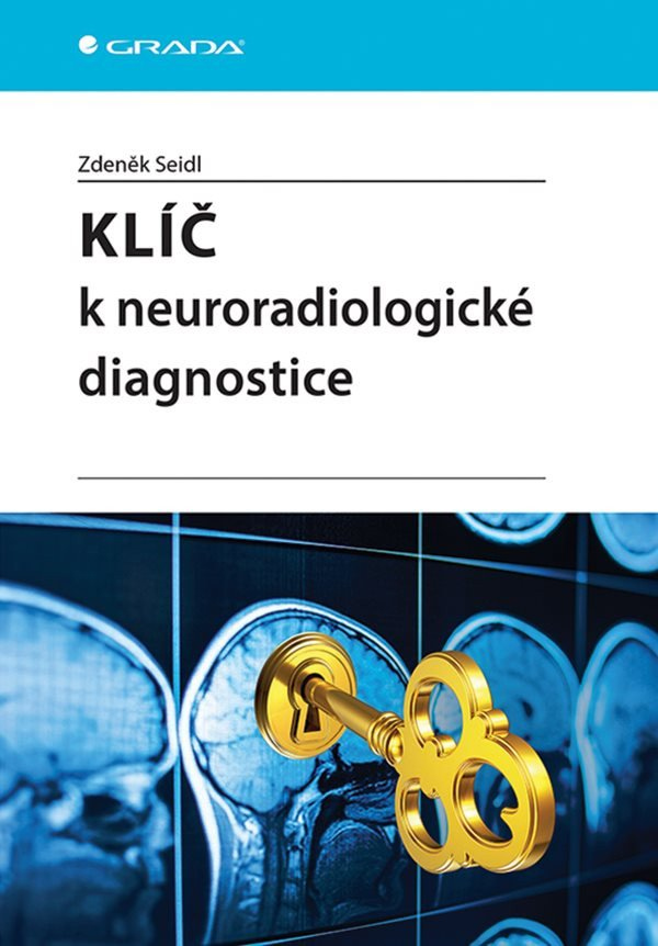 Levně Klíč k neuroradiologické diagnostice