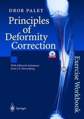 Principles of Deformity Correction, Exercise Workbook Springer-Verlag Berlin and Heidelberg GmbH & Co. KG