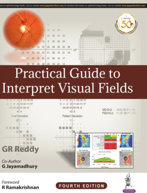 Practical Guide to Interpret Visual Fields