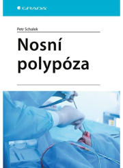 Nosní polypóza