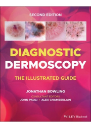 Diagnostic Dermoscopy, The Illustrated Guide